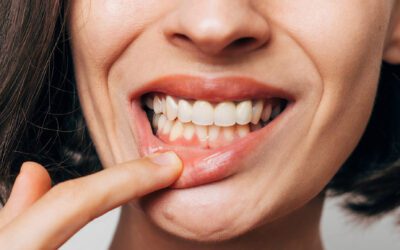 How to Prevent or Slow Down Gum Disease